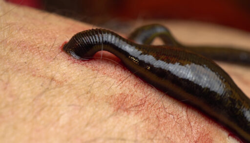 Close-up of a leech attached to a human arm.