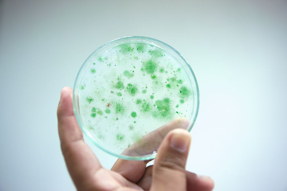 Colony of blue green algae in culture medium plate, Microbiology.