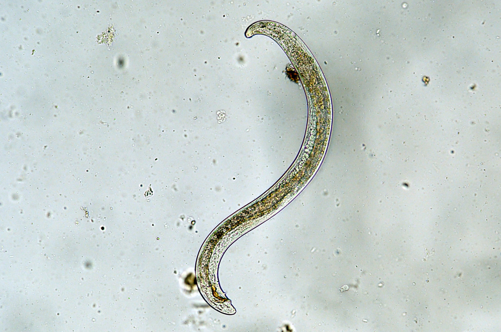 A microscope view of a long nematode round worm.